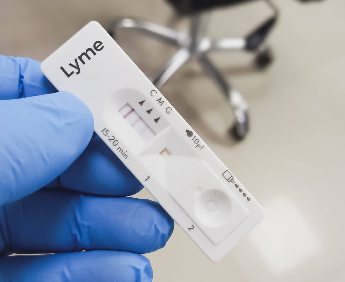 how do you test for lyme disease